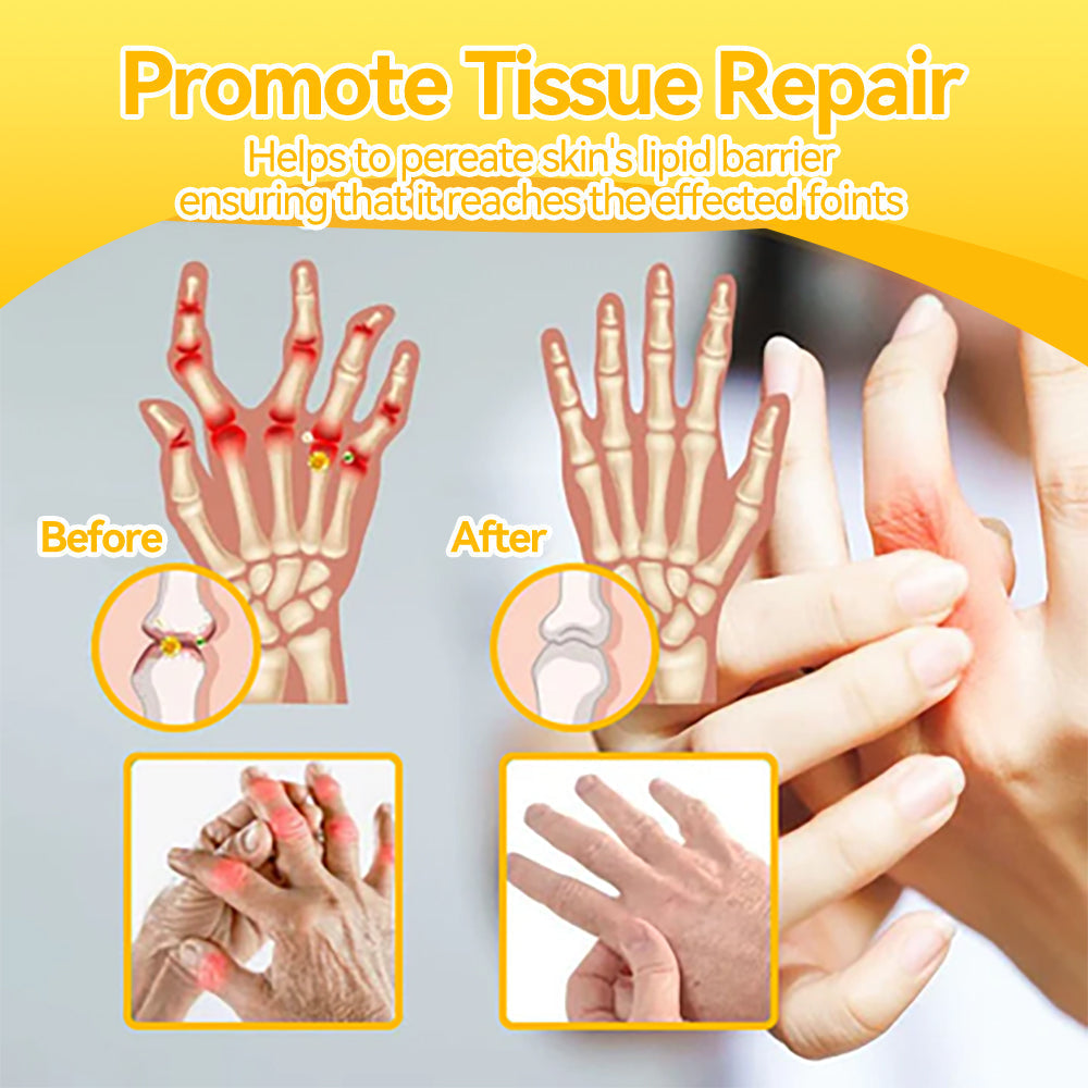 【𝐃𝐨𝐜𝐭𝐨𝐫'𝐬 𝐫𝐞𝐜𝐨𝐦𝐦𝐞𝐧𝐝𝐚𝐭𝐢𝐨𝐧】👩⚕️𝐅𝐀𝐓𝐎𝐍𝐆™ 𝐁𝐞𝐞 𝐕𝐞𝐧𝐨𝐦 𝐉𝐨𝐢𝐧𝐭 𝐂𝐫𝐞𝐚𝐦 - 𝐑𝐞𝐥𝐢𝐞𝐟 𝐚𝐧𝐝 𝐑𝐞𝐜𝐨𝐯𝐞𝐫𝐲🌻