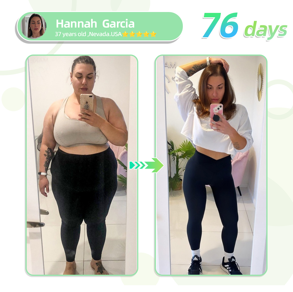 [See results in 7 days]🌲🌲Oyikey® SMGT-GLP-1 Nano Microneedle Patch（Painless, long-lasting, addressing diabetes, obesity, and cardiovascular diseases）