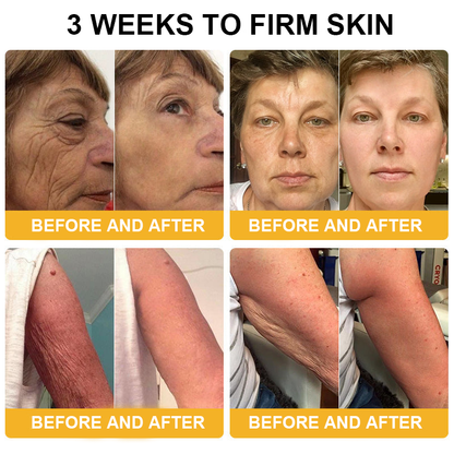 𝐃𝐨𝐫𝐦𝐨𝐫𝐧𝐚™ 𝐁𝐞𝐞 𝐕𝐞𝐧𝐨𝐦 𝐑𝐞𝐭𝐢𝐧𝐨𝐥 𝐒𝐤𝐢𝐧 𝐒𝐚𝐥𝐯𝐞 𝐎𝐢𝐧𝐭𝐦𝐞𝐧𝐭 🐝𝐀𝐀𝐃 𝐑𝐄𝐂𝐎𝐌𝐌𝐄𝐍𝐃𝐒(🔥55% Off for a Limited Time!)