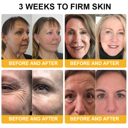 𝐃𝐨𝐫𝐦𝐨𝐫𝐧𝐚™ 𝐁𝐞𝐞 𝐕𝐞𝐧𝐨𝐦 𝐑𝐞𝐭𝐢𝐧𝐨𝐥 𝐒𝐤𝐢𝐧 𝐒𝐚𝐥𝐯𝐞 𝐎𝐢𝐧𝐭𝐦𝐞𝐧𝐭 🐝𝐀𝐀𝐃 𝐑𝐄𝐂𝐎𝐌𝐌𝐄𝐍𝐃𝐒(🔥55% Off for a Limited Time!)