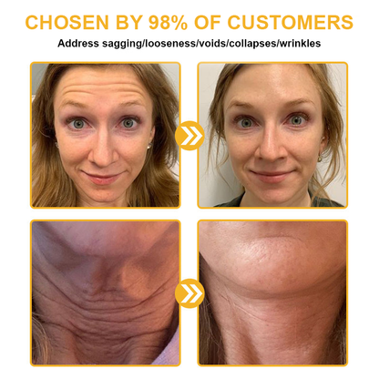 𝐃𝐨𝐫𝐦𝐨𝐫𝐧𝐚™ 𝐁𝐞𝐞 𝐕𝐞𝐧𝐨𝐦 𝐑𝐞𝐭𝐢𝐧𝐨𝐥 𝐒𝐤𝐢𝐧 𝐒𝐚𝐥𝐯𝐞 𝐎𝐢𝐧𝐭𝐦𝐞𝐧𝐭 🐝𝐀𝐀𝐃 𝐑𝐄𝐂𝐎𝐌𝐌𝐄𝐍𝐃𝐒(🔥55% Off for a Limited Time!)
